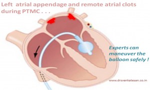 kidney stone specialist in pune