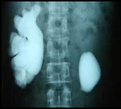 urologist surgeon in pune