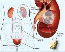 urologist surgeon in pune