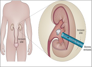 urologist surgeon in pune