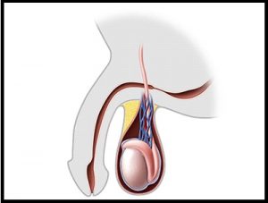 treatment of urethral stricture in pune